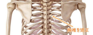 背中の痛み 肩甲骨との間の痛みでお悩みの方はご覧ください 新潟市整体 小林カイロプラクティック